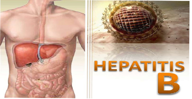 Tanda Tanda Seseorang Tertular Hepatitis B