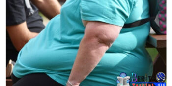 Hebohnya Evakuasi Pria Obesitas Bobot 300 Kg, Libatkan 50 Petugas